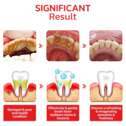 Probiotic Ultra Whitening Toothpaste